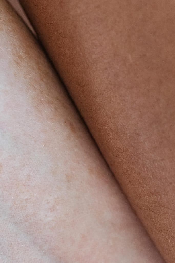 Skin on skin pressed against one another.